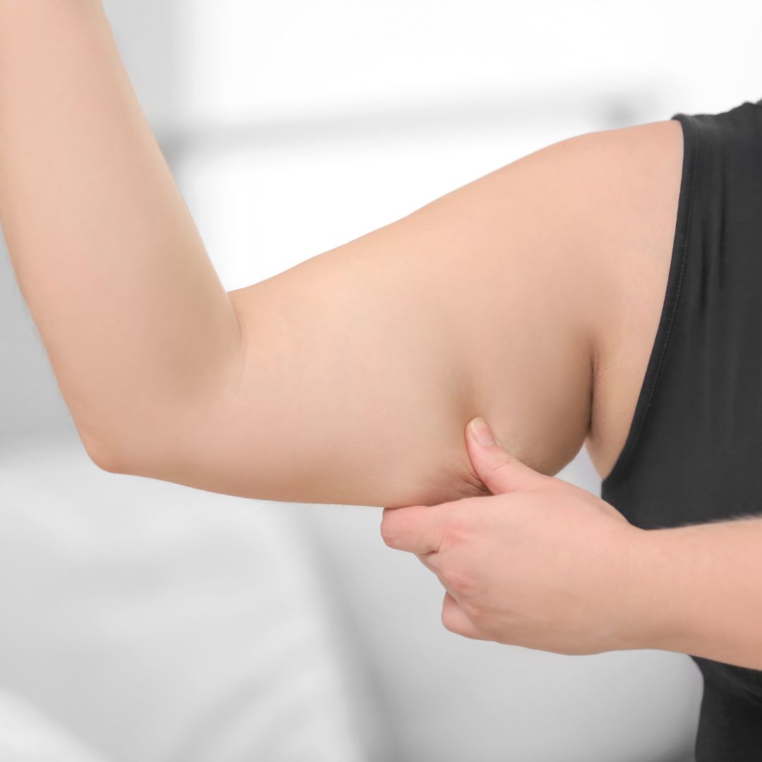 Armonización Corporal: reducción de grasa localizada y tensado (triceps)